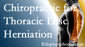 Cox Chiropractic Medicine Inc diagnoses and manages thoracic disc herniation pain and relieves its symptoms like unexplained abdominal pain or other gastrointestinal issues. 