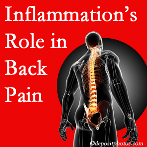 The role of inflammation in Fort Wayne back pain is real. Chiropractic care can help.