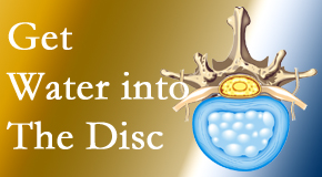 Cox Chiropractic Medicine Inc uses spinal manipulation and exercise to boost the diffusion of water into the disc which helps the health of the disc.