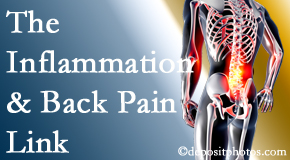 Cox Chiropractic Medicine Inc tackles the inflammatory process that accompanies back pain as well as the pain itself.