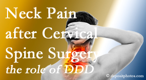 Cox Chiropractic Medicine Inc offers gentle treatment for neck pain after neck surgery.
