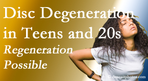 Cox Chiropractic Medicine Inc relieves back pain due to disc degeneration in younger people in their teens and 20s.