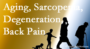 Cox Chiropractic Medicine Inc lessens a lot of back pain and sees a lot of related sarcopenia and back muscle degeneration.