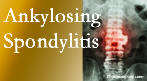 Ankylosing spondylitis is gently cared for by your Fort Wayne chiropractor.
