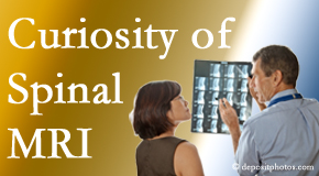 Fort Wayne MRIs for spinal stenosis may be revealing…or puzzling.