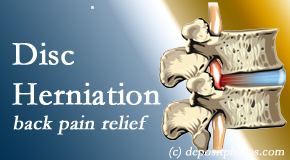 Cox Chiropractic Medicine Inc uses non-surgical treatment for relief of disc herniation related back pain. 