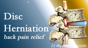 Cox Chiropractic Medicine Inc uses non-surgical treatment for relief of disc herniation related back pain.