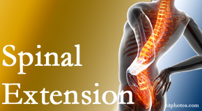 Cox Chiropractic Medicine Inc knows the role of extension in spinal motion, its necessity, its benefits and potential harmful effects. 