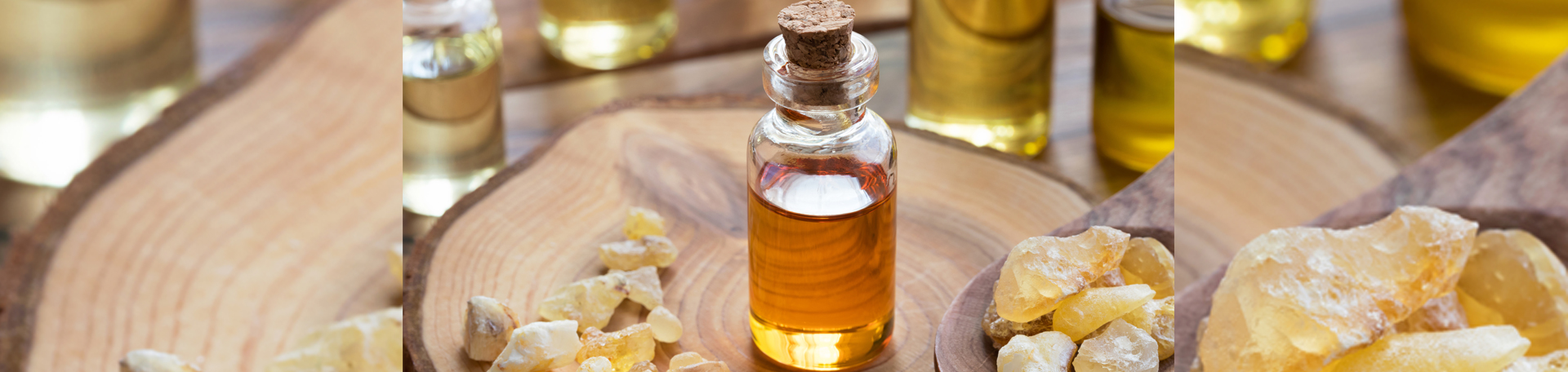 Fort Wayne anti-inflammatory frankincense