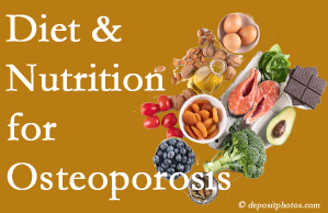 Fort Wayne osteoporosis prevention tips from your chiropractor include improved diet and nutrition and reduced sodium, bad fats, and sugar intake. 
