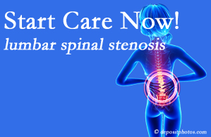 Cox Chiropractic Medicine Inc shares research that emphasizes that non-operative treatment for spinal stenosis within a month of diagnosis is beneficial. 
