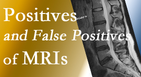 Cox Chiropractic Medicine Inc carefully chooses when and if MRI images are needed to guide the Fort Wayne chiropractic treatment plan.