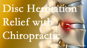 Cox Chiropractic Medicine Inc gently treats the disc herniation causing back pain. 